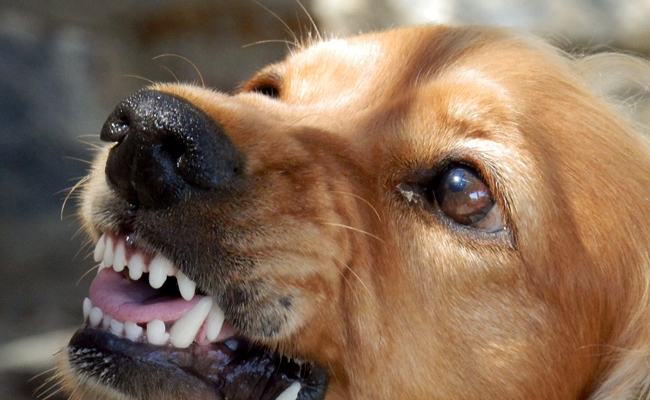 Urgent: un enfant mordu par sept (7)chiens à Dabondy port dans la commune de Matoto